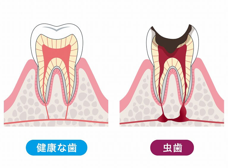 一般歯科